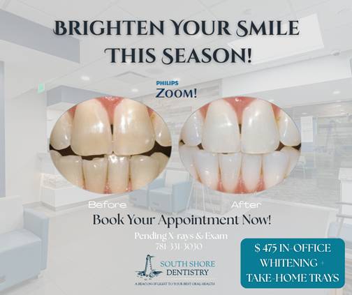 Zoom Whitening